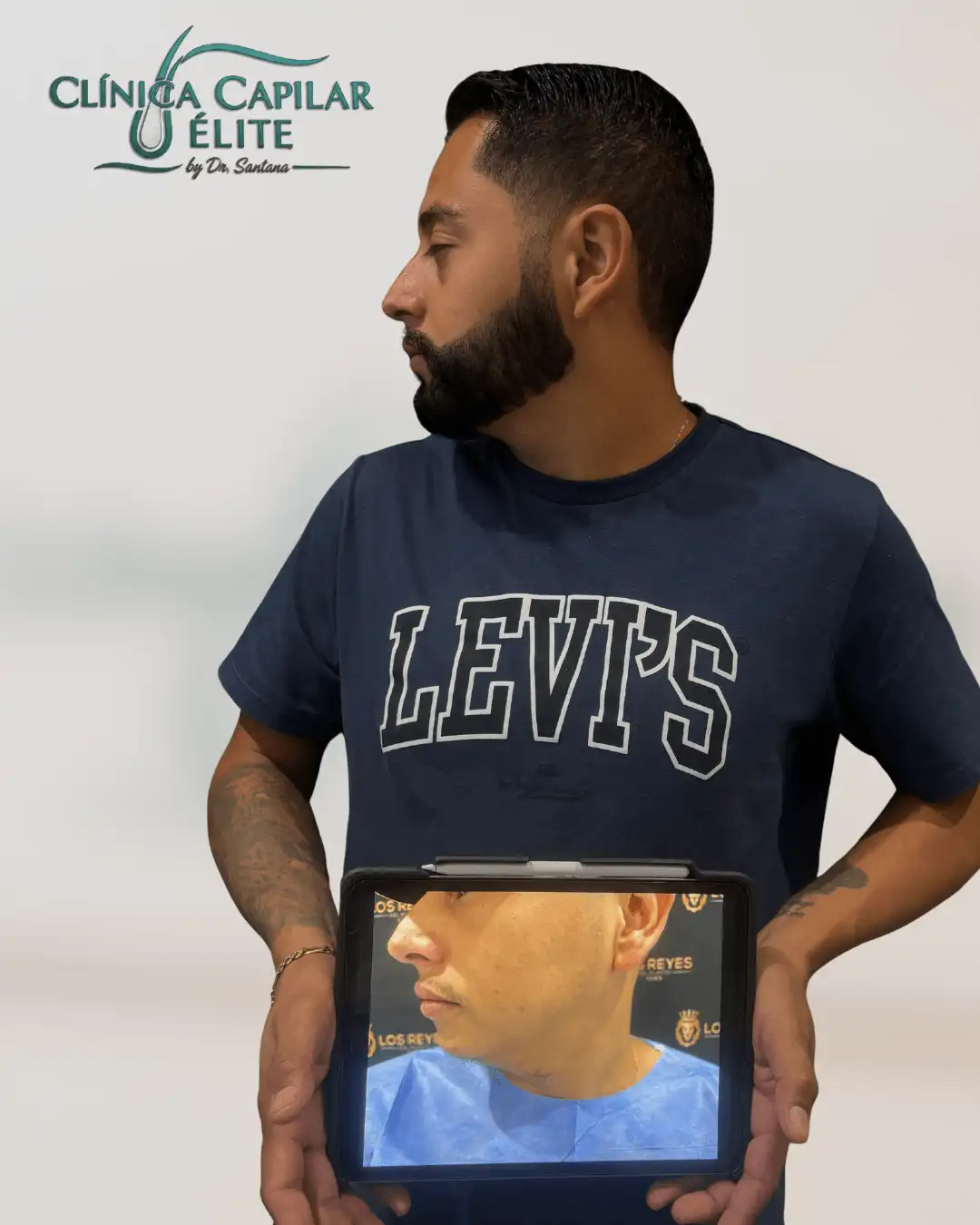 mj